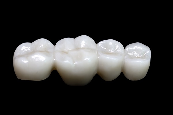 How A Dental Bridge Can Restore Your Smile