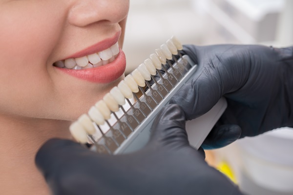 Everything You Need To Know About Dental Veneers