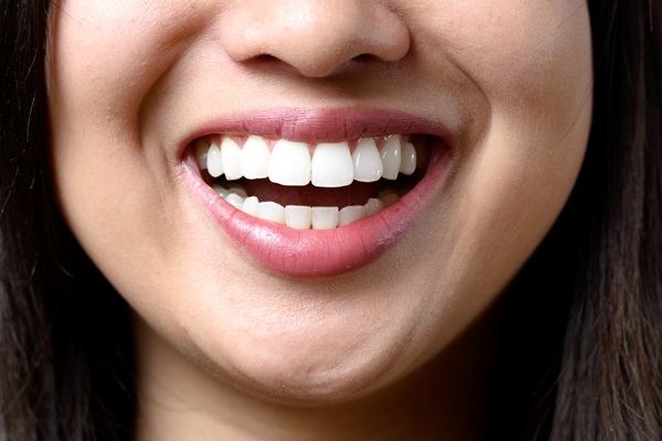 Everything You Need To Know About A Full Mouth Reconstruction